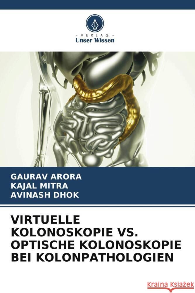 VIRTUELLE KOLONOSKOPIE VS. OPTISCHE KOLONOSKOPIE BEI KOLONPATHOLOGIEN Arora, Gaurav, Mitra, Kajal, Dhok, Avinash 9786204773179