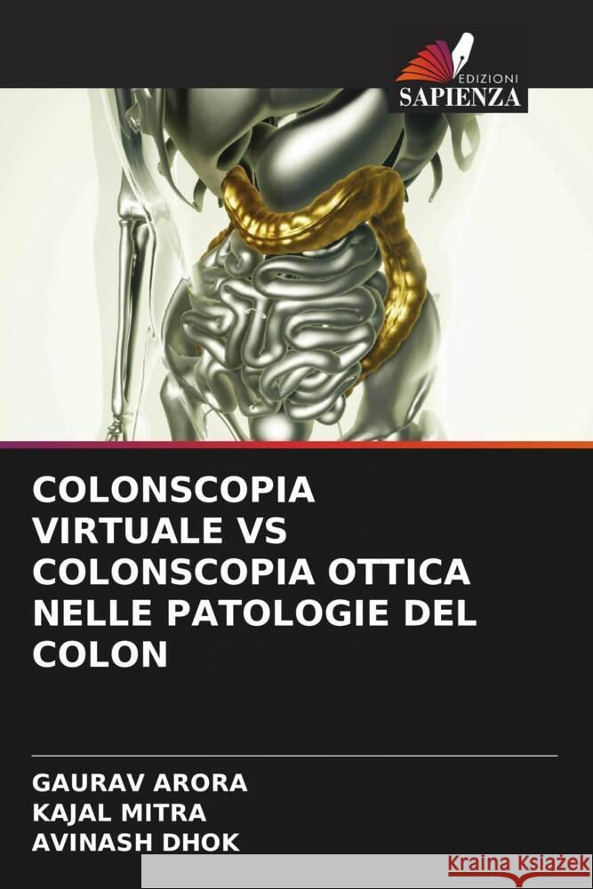 COLONSCOPIA VIRTUALE VS COLONSCOPIA OTTICA NELLE PATOLOGIE DEL COLON Arora, Gaurav, Mitra, Kajal, Dhok, Avinash 9786204773209