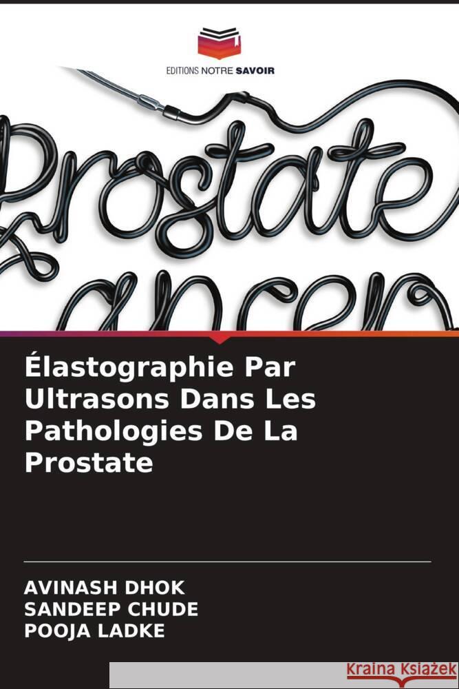 Élastographie Par Ultrasons Dans Les Pathologies De La Prostate Dhok, Avinash, Chude, Sandeep, Ladke, Pooja 9786204773384