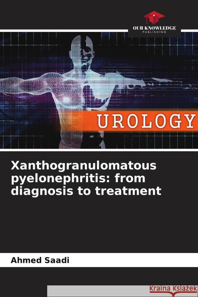 Xanthogranulomatous pyelonephritis: from diagnosis to treatment Saadi, Ahmed 9786204777511