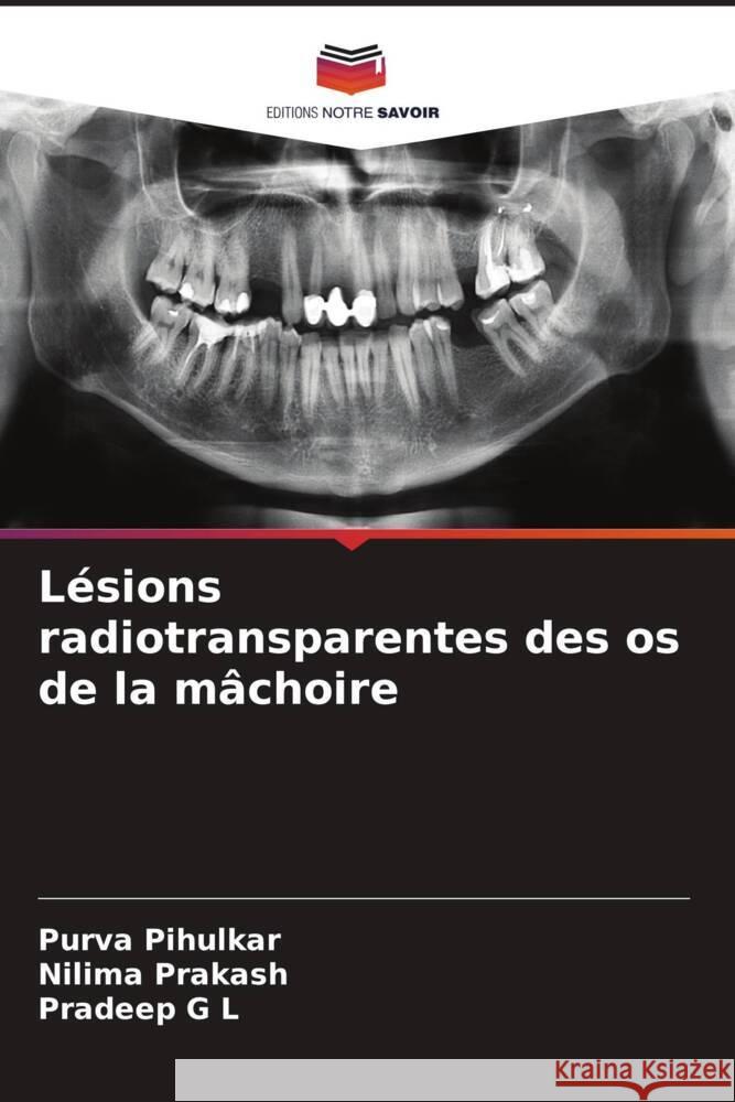 Lésions radiotransparentes des os de la mâchoire Pihulkar, Purva, Prakash, Nilima, G L, Pradeep 9786204778174 Editions Notre Savoir