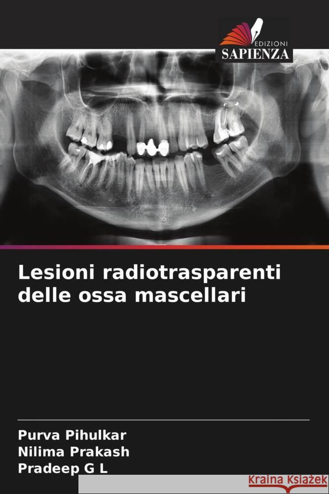 Lesioni radiotrasparenti delle ossa mascellari Pihulkar, Purva, Prakash, Nilima, G L, Pradeep 9786204778181 Edizioni Sapienza