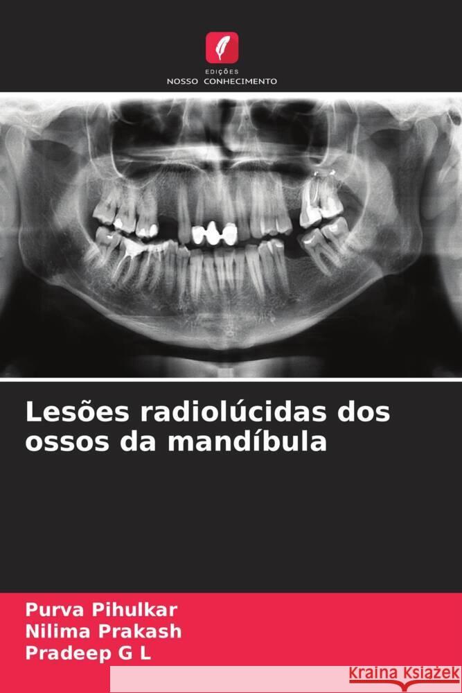 Lesões radiolúcidas dos ossos da mandíbula Pihulkar, Purva, Prakash, Nilima, G L, Pradeep 9786204778198 Edições Nosso Conhecimento