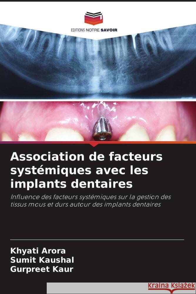 Association de facteurs systémiques avec les implants dentaires Arora, Khyati, Kaushal, Sumit, Kaur, Gurpreet 9786204785783