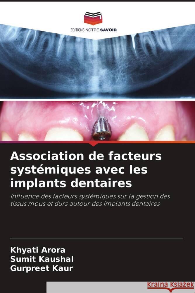 Association de facteurs systémiques avec les implants dentaires Arora, Khyati, Kaushal, Sumit, Kaur, Gurpreet 9786204785783 Editions Notre Savoir