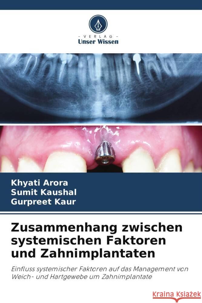 Zusammenhang zwischen systemischen Faktoren und Zahnimplantaten Arora, Khyati, Kaushal, Sumit, Kaur, Gurpreet 9786204785790 Verlag Unser Wissen