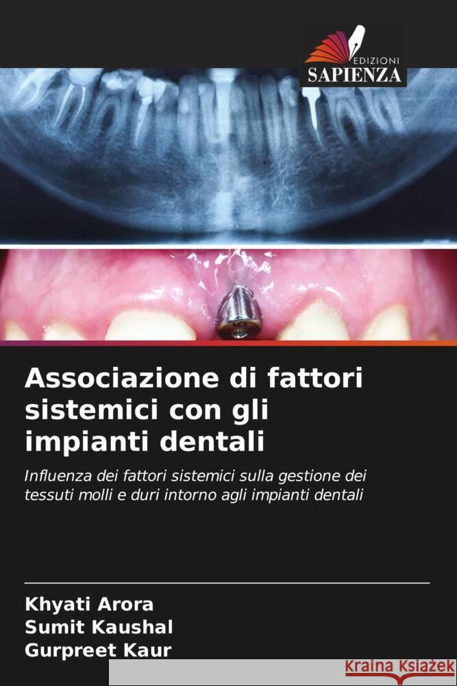 Associazione di fattori sistemici con gli impianti dentali Arora, Khyati, Kaushal, Sumit, Kaur, Gurpreet 9786204785806 Edizioni Sapienza