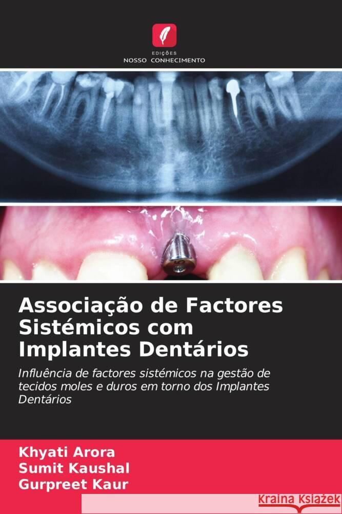 Associação de Factores Sistémicos com Implantes Dentários Arora, Khyati, Kaushal, Sumit, Kaur, Gurpreet 9786204785936 Edições Nosso Conhecimento