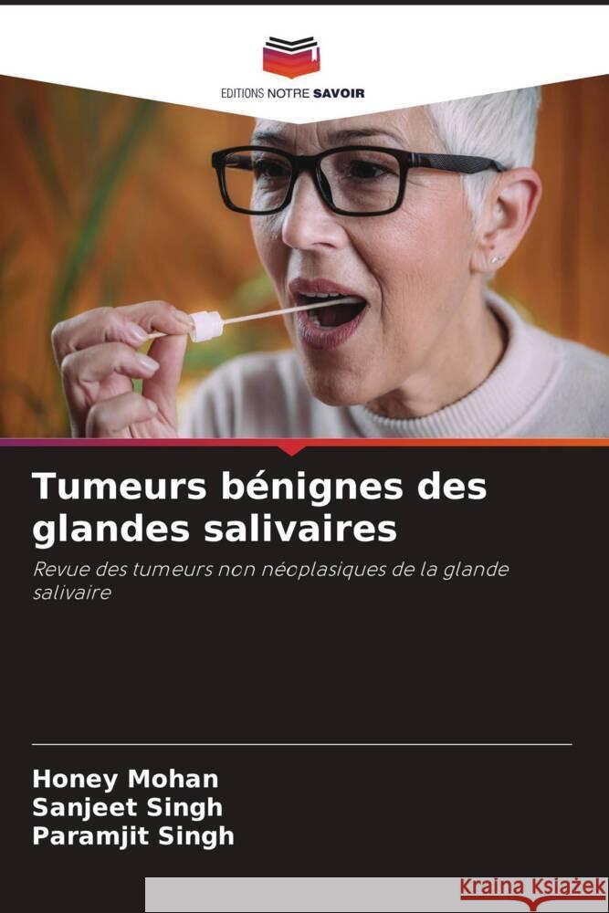 Tumeurs bénignes des glandes salivaires Mohan, Honey, Singh, Sanjeet, Singh, Paramjit 9786204786766 Editions Notre Savoir