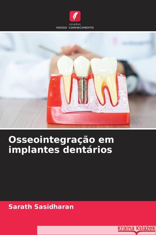 Osseointegração em implantes dentários Sasidharan, Sarath 9786204809779