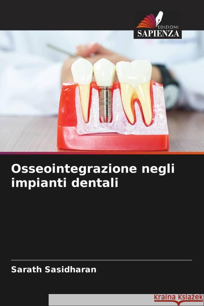 Osseointegrazione negli impianti dentali Sasidharan, Sarath 9786204809786