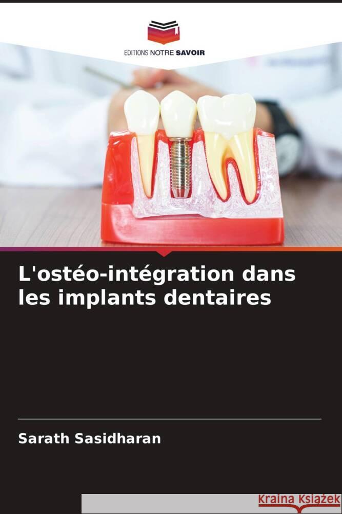 L'ostéo-intégration dans les implants dentaires Sasidharan, Sarath 9786204809793