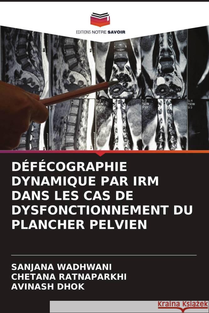 DÉFÉCOGRAPHIE DYNAMIQUE PAR IRM DANS LES CAS DE DYSFONCTIONNEMENT DU PLANCHER PELVIEN Wadhwani, Sanjana, Ratnaparkhi, Chetana, Dhok, Avinash 9786204812243