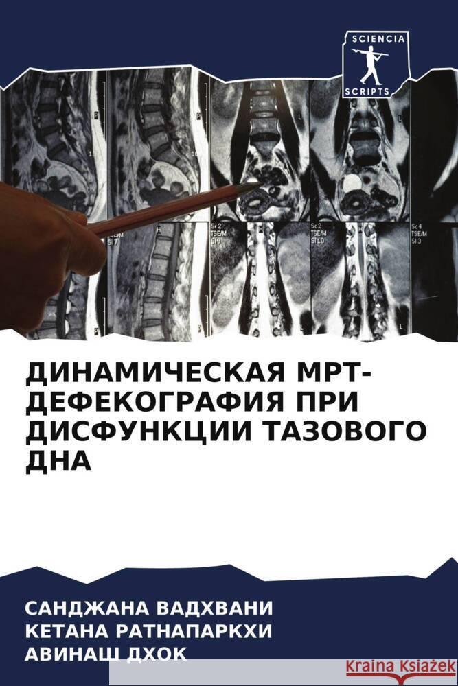 DINAMIChESKAYa MRT-DEFEKOGRAFIYa PRI DISFUNKCII TAZOVOGO DNA VADHVANI, SANDZhANA, RATNAPARKHI, KETANA, Dhok, Awinash 9786204812274