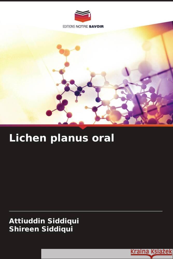 Lichen planus oral Siddiqui, Attiuddin, Siddiqui, Shireen 9786204812304 Editions Notre Savoir