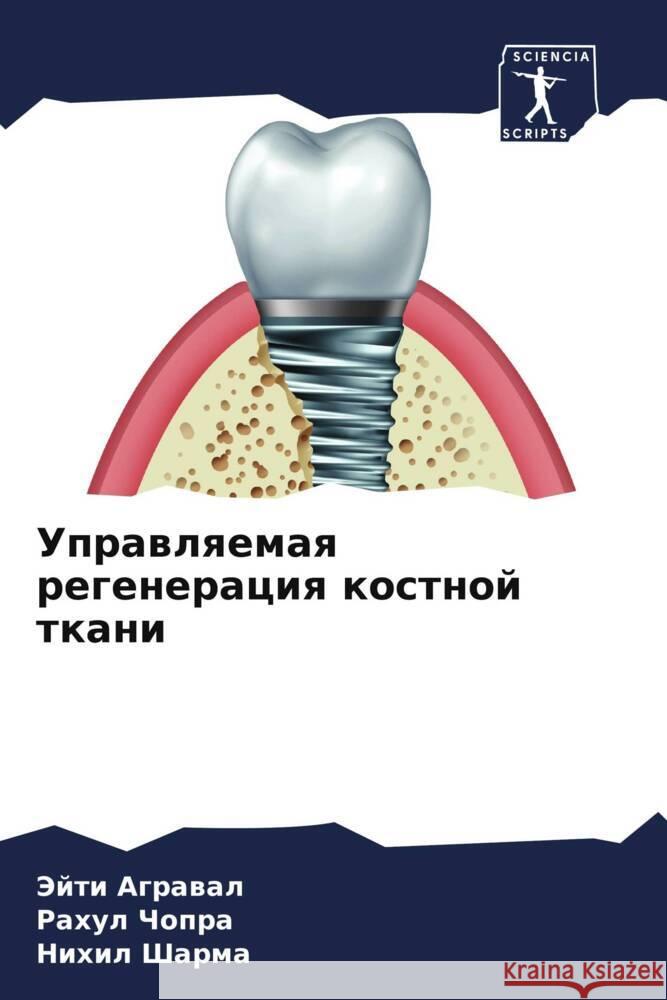 Uprawlqemaq regeneraciq kostnoj tkani Agrawal, Jejti, Chopra, Rahul, Sharma, Nihil 9786204820880 Sciencia Scripts