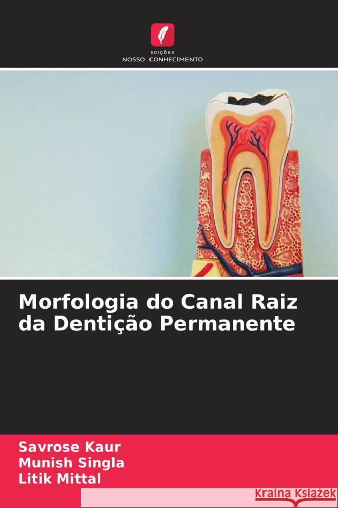 Morfologia do Canal Raiz da Denti??o Permanente Savrose Kaur Munish Singla Litik Mittal 9786204823034