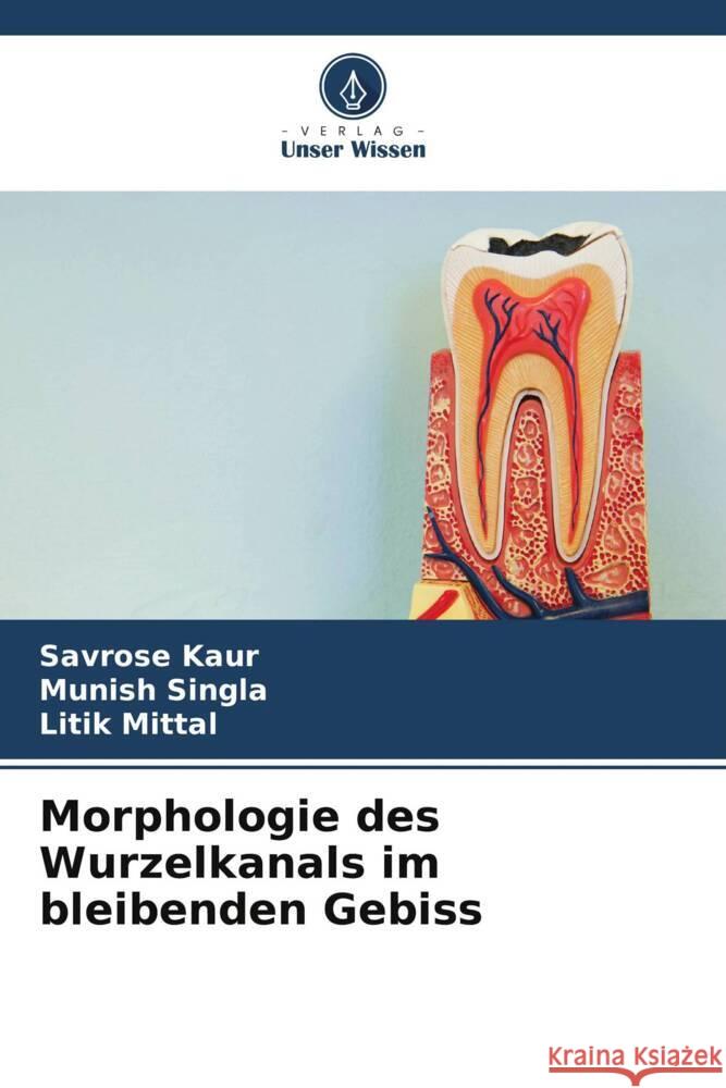 Morphologie des Wurzelkanals im bleibenden Gebiss Kaur, Savrose, Singla, Munish, Mittal, Litik 9786204823058