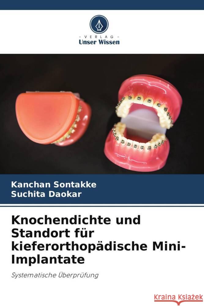 Knochendichte und Standort für kieferorthopädische Mini-Implantate Sontakke, Kanchan, Daokar, Suchita 9786204824048