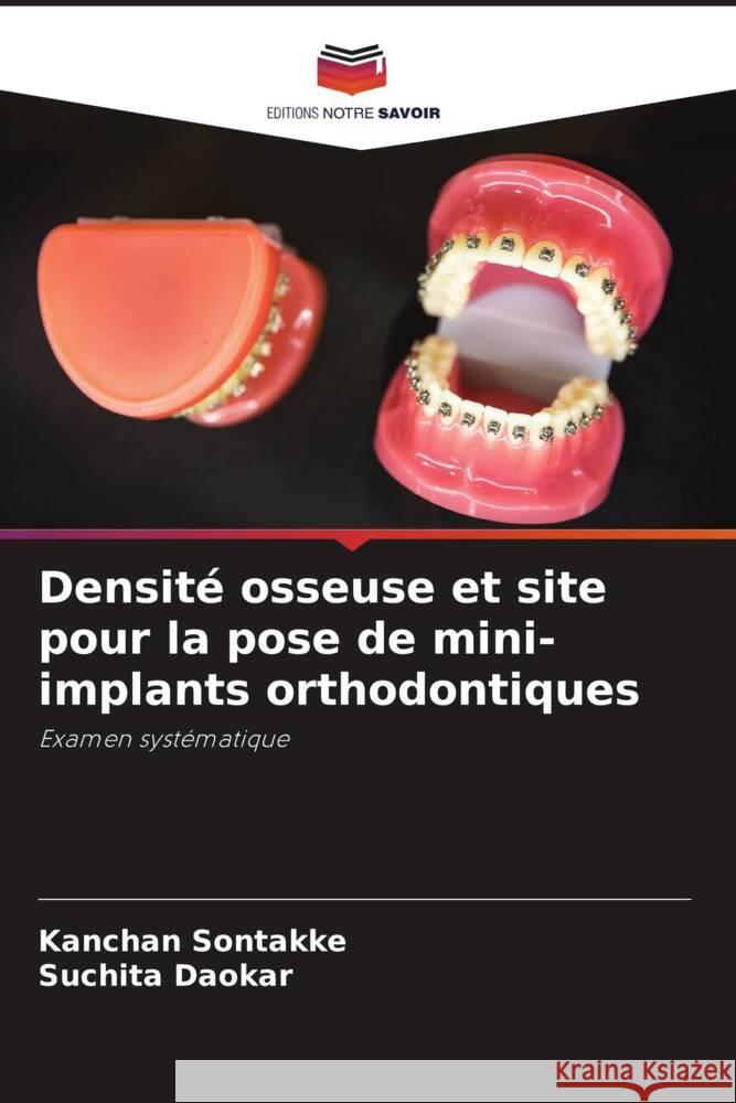 Densité osseuse et site pour la pose de mini-implants orthodontiques Sontakke, Kanchan, Daokar, Suchita 9786204824062