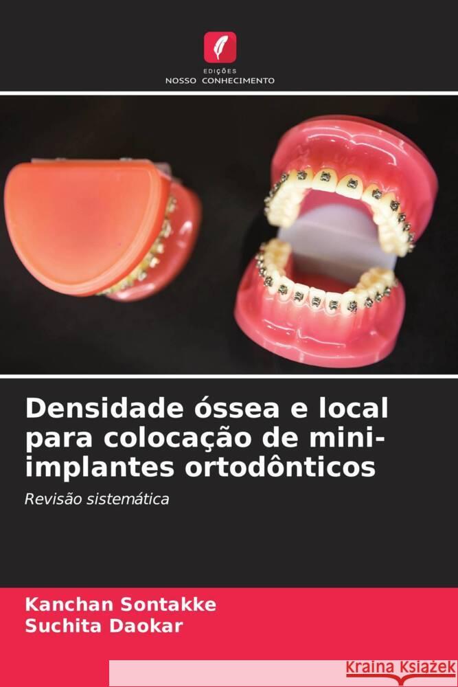 Densidade óssea e local para colocação de mini-implantes ortodônticos Sontakke, Kanchan, Daokar, Suchita 9786204824109