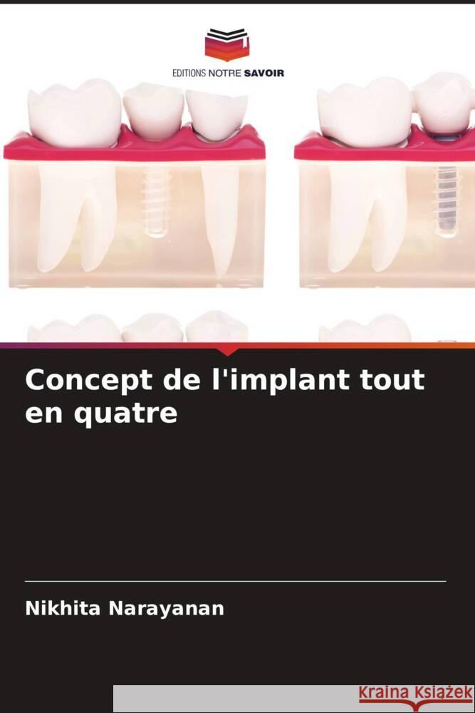 Concept de l'implant tout en quatre Narayanan, Nikhita 9786204824819