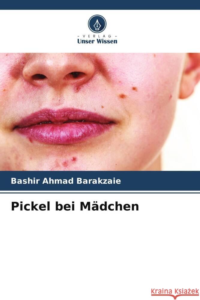 Pickel bei Mädchen Barakzaie, Bashir Ahmad 9786204831831