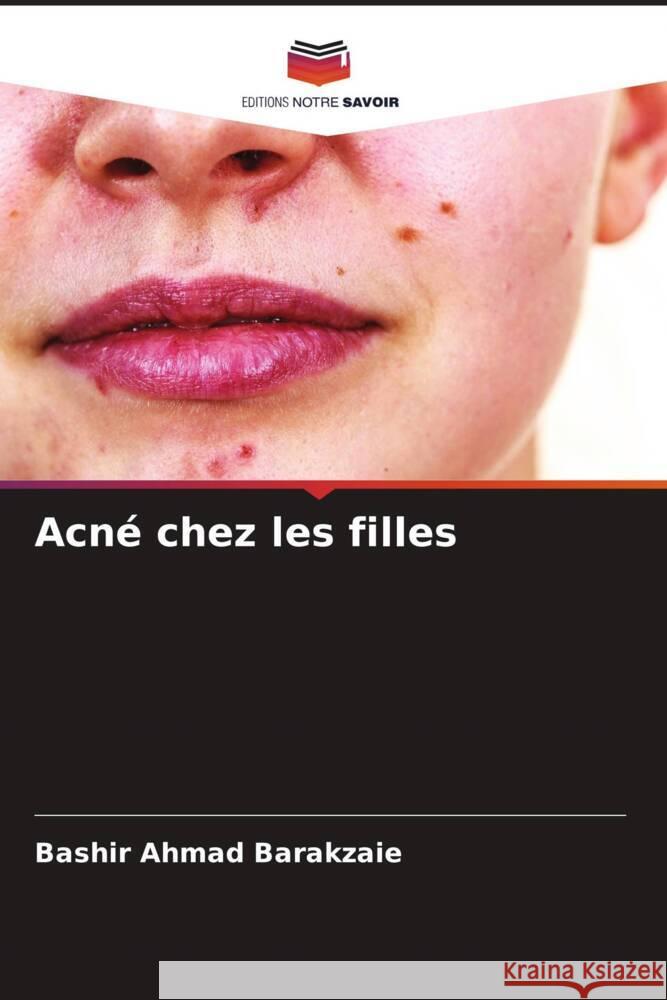 Acné chez les filles Barakzaie, Bashir Ahmad 9786204831855