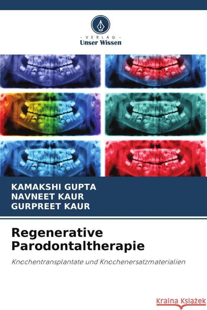 Regenerative Parodontaltherapie GUPTA, KAMAKSHI, Kaur, Navneet, Kaur, Gurpreet 9786204834238