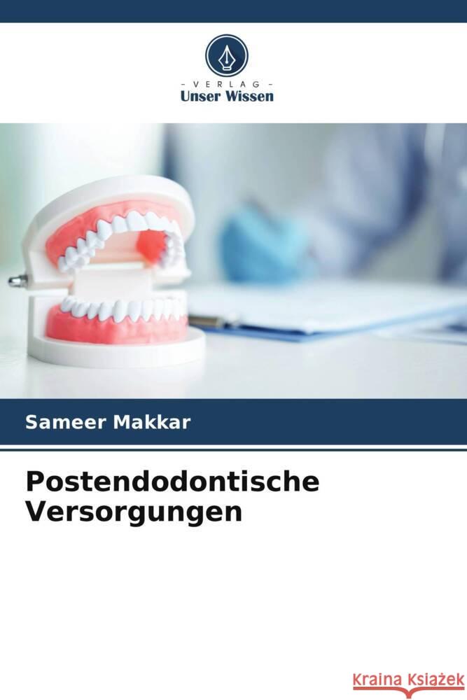 Postendodontische Versorgungen Sameer Makkar Uzma Mushtaq Tamanpreet Kaur 9786204834719 Verlag Unser Wissen