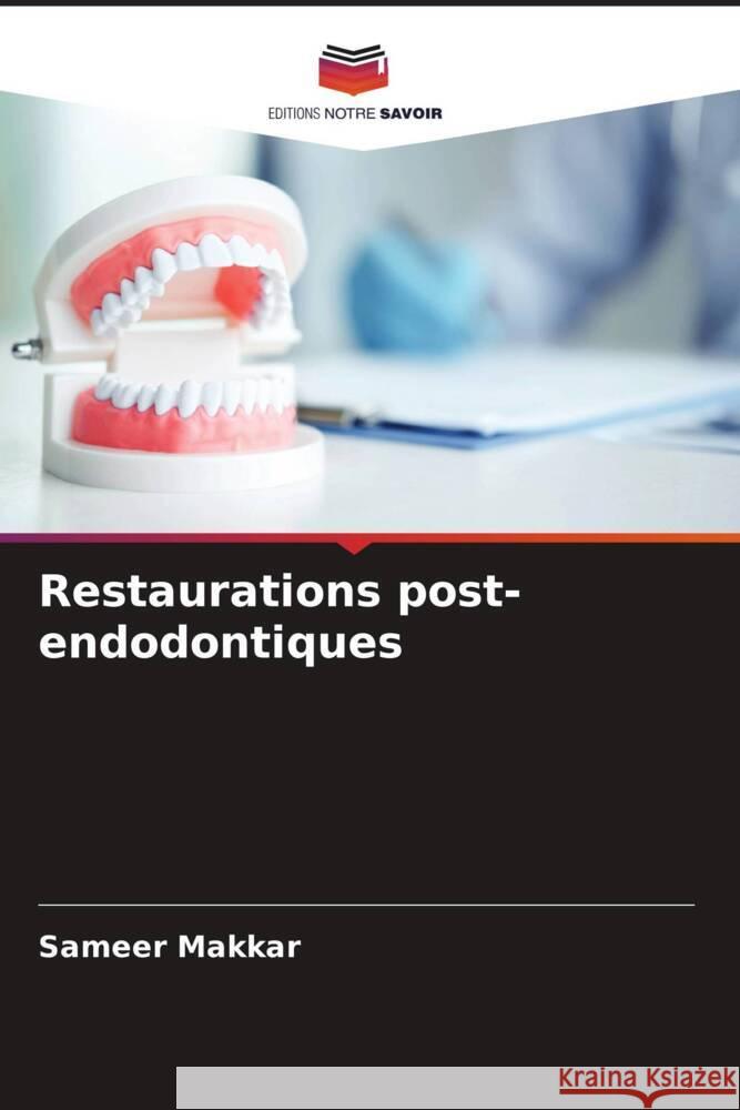 Restaurations post-endodontiques Sameer Makkar Uzma Mushtaq Tamanpreet Kaur 9786204834733 Editions Notre Savoir