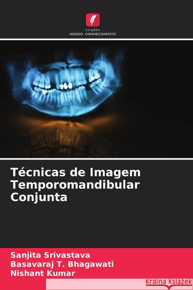 Técnicas de Imagem Temporomandibular Conjunta Srivastava, Sanjita, Bhagawati, Basavaraj T., Kumar, Nishant 9786204837321