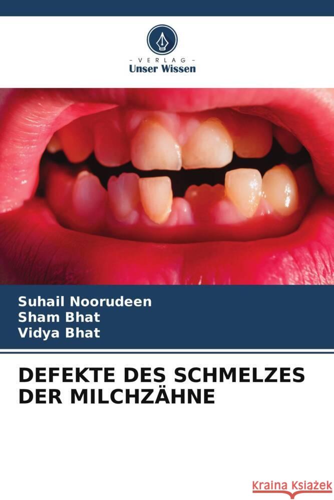 DEFEKTE DES SCHMELZES DER MILCHZÄHNE Noorudeen, Suhail, Bhat, Sham, Bhat, Vidya 9786204845883