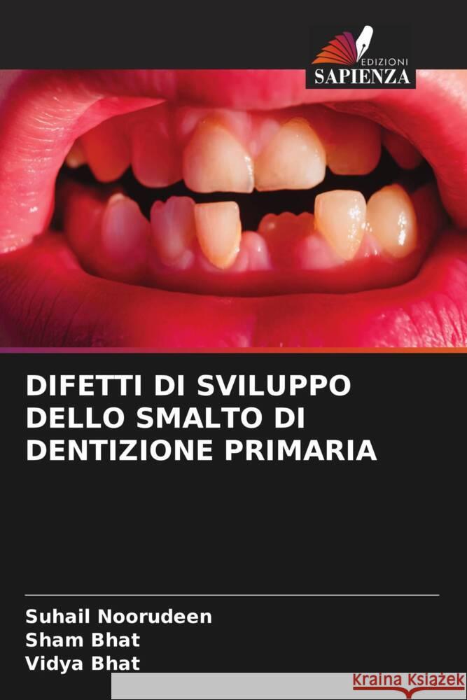 DIFETTI DI SVILUPPO DELLO SMALTO DI DENTIZIONE PRIMARIA Noorudeen, Suhail, Bhat, Sham, Bhat, Vidya 9786204845920