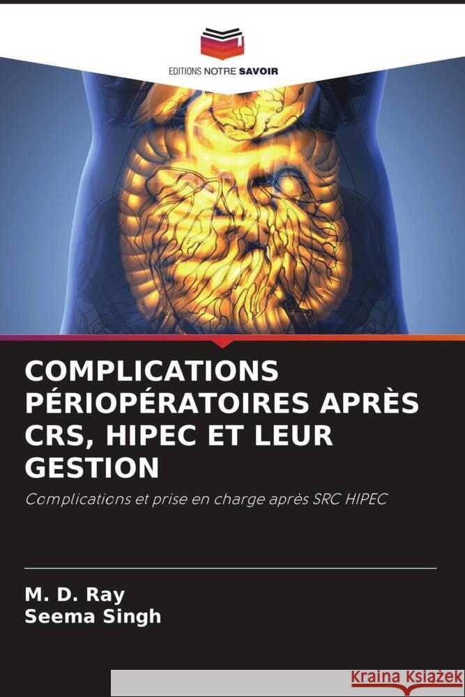 COMPLICATIONS PÉRIOPÉRATOIRES APRÈS CRS, HIPEC ET LEUR GESTION Ray, M. D., Singh, Seema 9786204850528