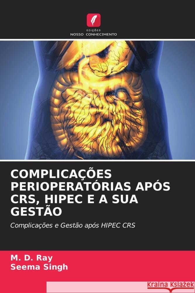 COMPLICAÇÕES PERIOPERATÓRIAS APÓS CRS, HIPEC E A SUA GESTÃO Ray, M. D., Singh, Seema 9786204850788