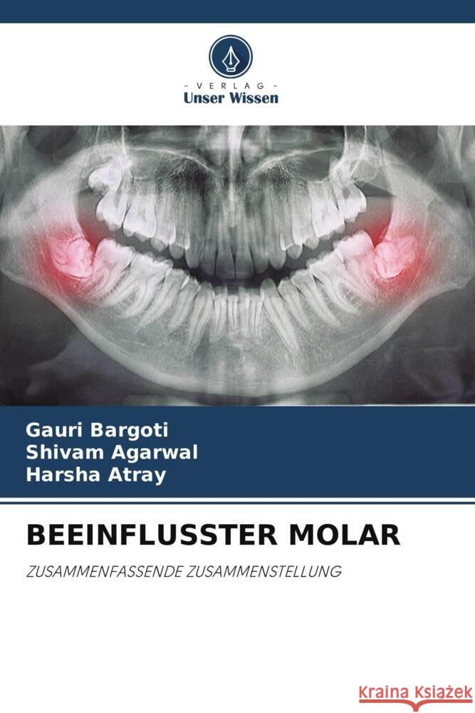 BEEINFLUSSTER MOLAR Bargoti, Gauri, Agarwal, Shivam, Atray, Harsha 9786204857695