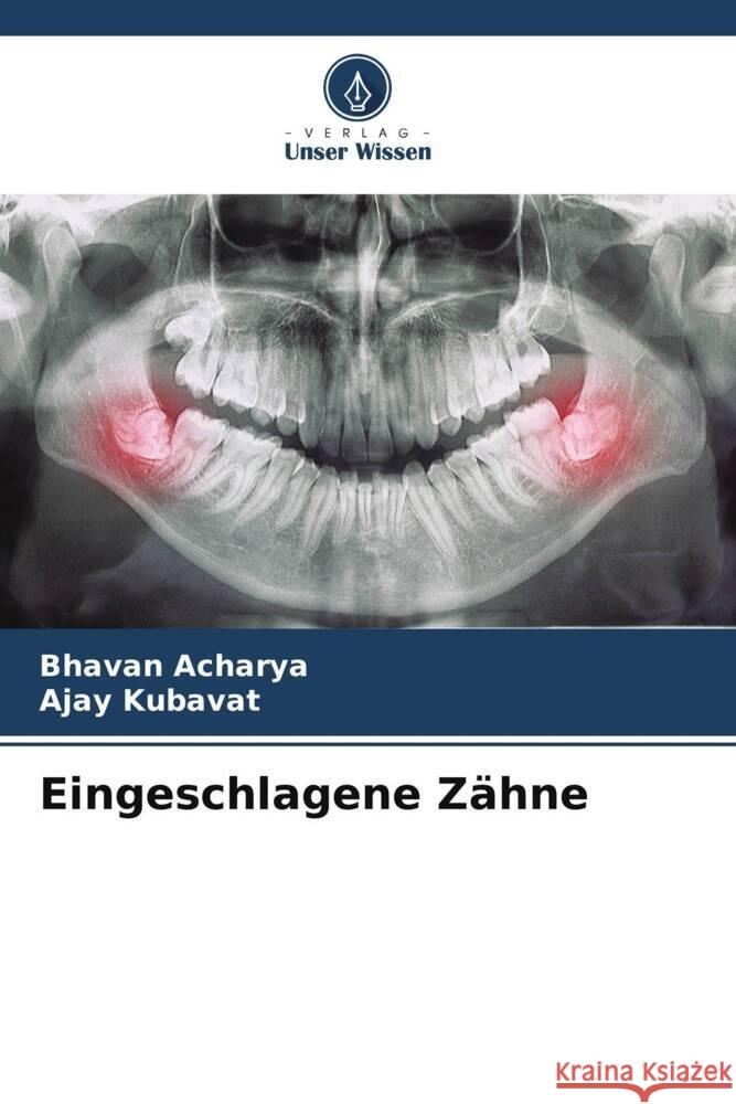 Eingeschlagene Zähne Acharya, Bhavan, KUBAVAT, AJAY 9786204858197 Verlag Unser Wissen