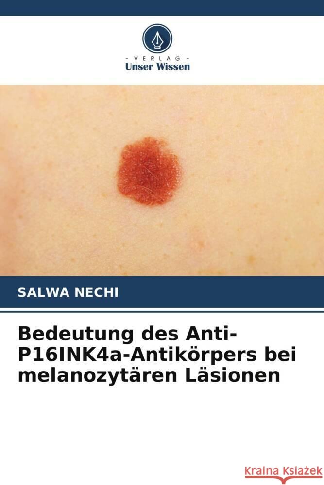 Bedeutung des Anti-P16INK4a-Antikörpers bei melanozytären Läsionen Nechi, Salwa 9786204865157 Verlag Unser Wissen