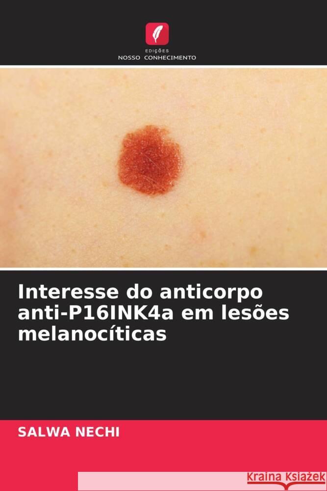 Interesse do anticorpo anti-P16INK4a em lesões melanocíticas Nechi, Salwa 9786204865171