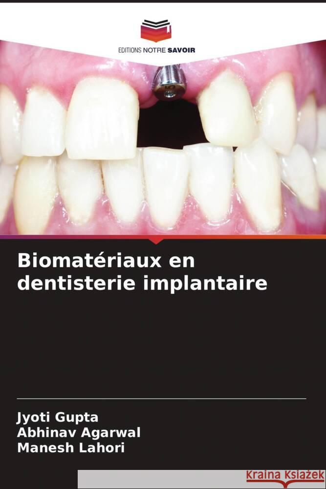 Biomatériaux en dentisterie implantaire Gupta, Jyoti, Agarwal, Abhinav, Lahori, Manesh 9786204865515