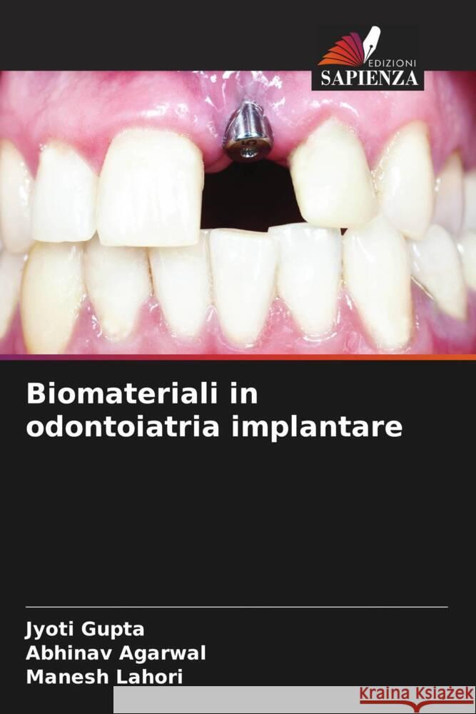 Biomateriali in odontoiatria implantare Gupta, Jyoti, Agarwal, Abhinav, Lahori, Manesh 9786204865553