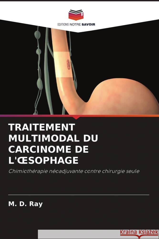 TRAITEMENT MULTIMODAL DU CARCINOME DE L' SOPHAGE Ray, M. D. 9786204889672 Editions Notre Savoir