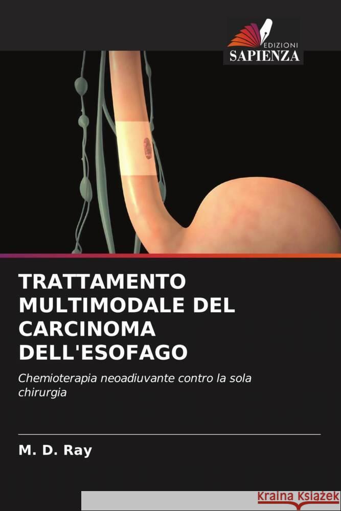 TRATTAMENTO MULTIMODALE DEL CARCINOMA DELL'ESOFAGO Ray, M. D. 9786204889740 Edizioni Sapienza