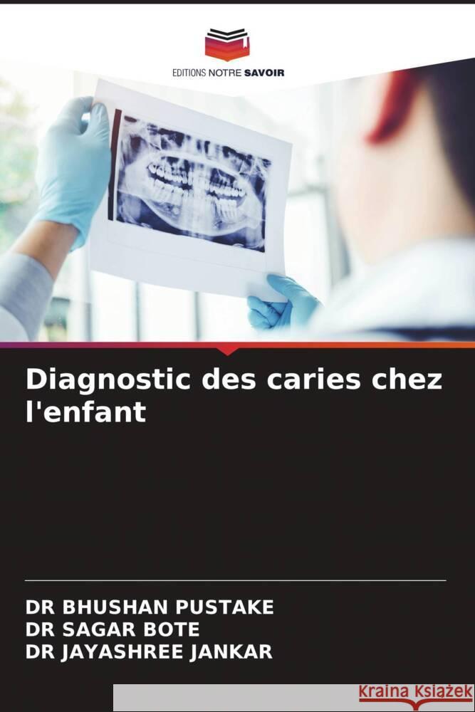 Diagnostic des caries chez l'enfant PUSTAKE, DR BHUSHAN, BOTE, DR SAGAR, JANKAR, DR JAYASHREE 9786204890715