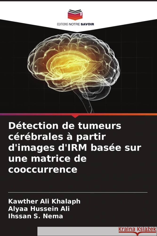 Détection de tumeurs cérébrales à partir d'images d'IRM basée sur une matrice de cooccurrence Khalaph, Kawther Ali, Ali, Alyaa Hussein, Nema, Ihssan S. 9786204900490