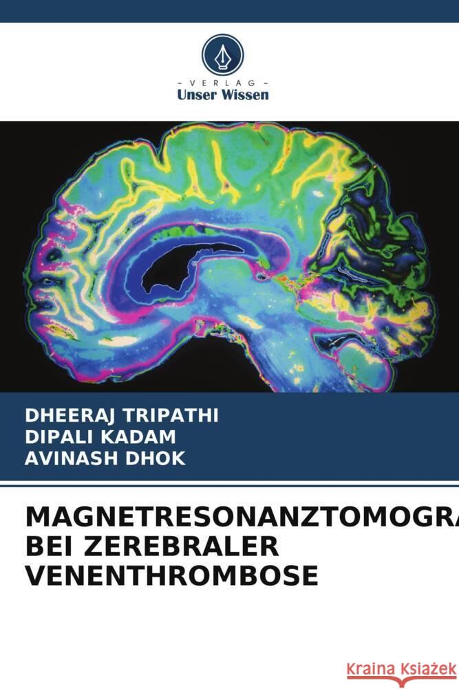 MAGNETRESONANZTOMOGRAPHIE BEI ZEREBRALER VENENTHROMBOSE Tripathi, Dheeraj, Kadam, Dipali, Dhok, Avinash 9786204902791