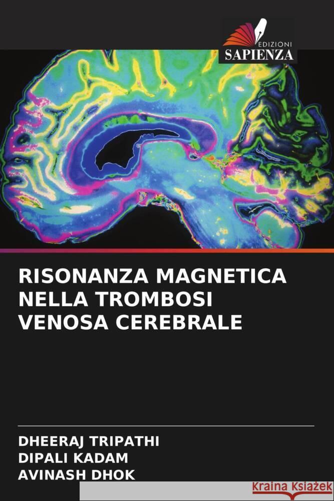 RISONANZA MAGNETICA NELLA TROMBOSI VENOSA CEREBRALE Tripathi, Dheeraj, Kadam, Dipali, Dhok, Avinash 9786204902821