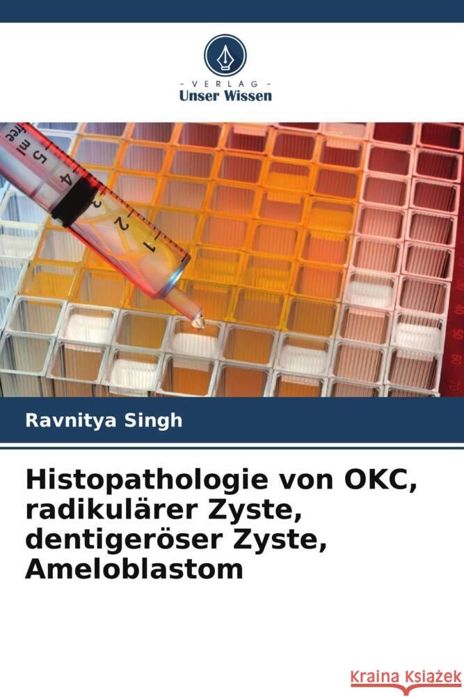 Histopathologie von OKC, radikulärer Zyste, dentigeröser Zyste, Ameloblastom Singh, Ravnitya 9786204904313