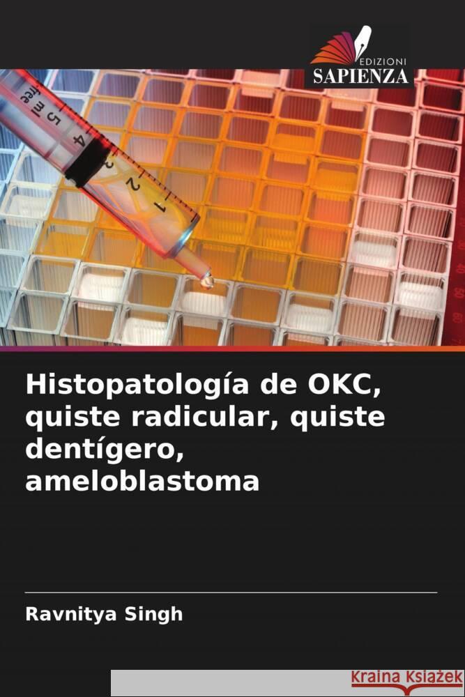 Histopatología de OKC, quiste radicular, quiste dentígero, ameloblastoma Singh, Ravnitya 9786204904344